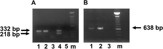 Fig. 6. HCMV IE and L gene expression in the macrophages derived from infected CD34+ BM progenitor cells 28 days postinfection. (A) Ethidium bromide-stained 1% agarose gel of RT-PCR products of IE transcripts. The arrows indicate the RT-PCR products of unspliced IE transcripts of 332 bp and spliced IE transcript of 218 bp. Lane 1, RNA from the cultures infected with 95(2); lane 2, RNA from the cultures infected with Towne/lox2; lane 3, RNA from mock-infected cultures; lane 4, positive control of HCMV-infected fibroblasts displaying both the genomic size (unspliced; 332 bp) banding pattern and the RNA size (spliced; 218 bp) banding pattern; lane 5, RT-PCR H2O control. (B) Ethidium bromide stained 1% agarose gel of RT-PCR products of MCP transcripts. The arrows indicate RT-PCR product of unspliced MCP gene of 638 bp. Lane 1, RNA from the cultures infected with 95(2); lane 2, RNA from the cultures infected with Towne/lox2; lane 3, RNA from mock-infected cultures; lane m, 100-bp ladder (GIBCO/BRL). All RNA samples were treated with Rnase-free Dnase. Primers and predicted PCR products are listed in Table 1.