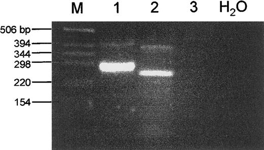 Fig. 2. RT-PCR analysis of ETV6/JAK2 fusion products. Total RNA from the ALL case (lane 1), the CML case (lane 2), and normal WBCs (lane 3) was used in a RT-PCR with primers located in the relevant exons of ETV6 and JAK2 (see Materials and Methods section). In each case a major product is observed, together with a minor product of a larger size. The different PCR products are the result of alternative splicing events as shown in Fig 3. Marker size is indicated to the left.