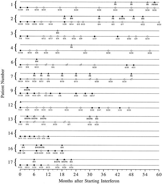 Fig. 1. Serial cytogenetic and PCR data for the 12 patients who achieved a complete cytogenetic remission on at least one occasion. Solid circles represent Ph-positive metaphases in the bone marrow and open circles represent Ph-negative marrow cytogenetics. The number of Ph-positive metaphases over the total number of metaphases counted is shown below each circle. Corresponding solid or open triangles represent PCR positive or negative testing of peripheral blood (PB) or bone marrow (BM). “cf” signifies bone marrow culture failure.