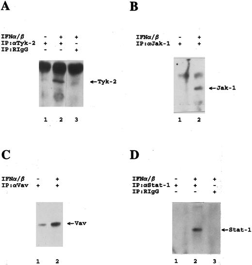 Fig. 2. Tyrosine phosphorylation of IFN-α–signaling elements in cells lacking expression of IRS-proteins. Antiphosphotyrosine immunoblots are shown. (A) 32DIR cells were incubated for 5 minutes at 37°C in the presence or absence of mouse IFNα/β as indicated, and cell lysates were immunoprecipitated with either an antibody against Tyk-2 (Santa Cruz) or nonimmune RIgG as indicated. (B) 32D cells were incubated for 5 minutes at 37°C in the presence or absence of mouse IFNα/β as indicated, and cell lysates were immunoprecipitated with an antibody against Jak-1 as indicated. (C) 32D cells were incubated for 5 minutes at 37°C in the presence or absence of mouse IFNα/β as indicated, and cell lysates were immunoprecipitated with an antibody against Vav as indicated. (D) 32D cells were incubated for 20 minutes at 37°C in the presence or absence or presence of mouse IFNα/β as indicated, and cell lysates were immunoprecipitated with either an antibody against Stat-1 (Santa Cruz) or nonimmune RIgG as indicated.