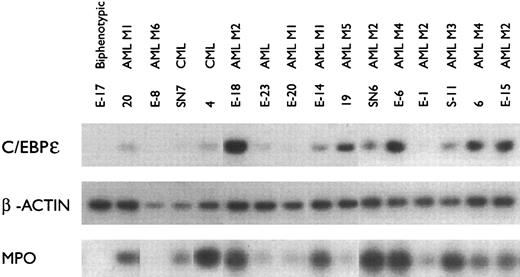 Fig. 2. C/EBPε and MPO mRNA expression in fresh leukemia samples. The mRNA was amplified using RT-PCR and examined as described in Fig 1. β-actin expression was used as an internal control.