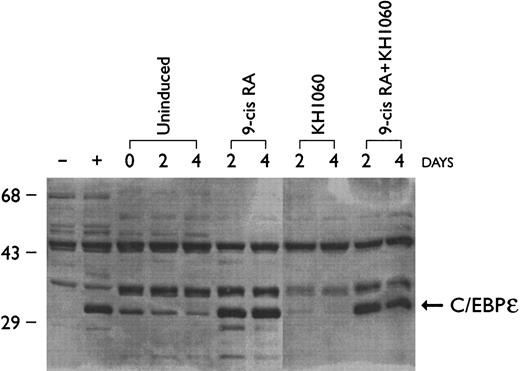 Fig. 5. Effect of 9-cis retinoic acid (9-cis–RA) and vitamin D analog (KH1060) on C/EBPε protein expression in NB4 cells. NB4 cells were cultured with 9-cis-RA (10−7 mol/L), KH1060 (10−7 mol/L) and 9-cis–RA + KH1060 (10−7 mol/L). Rat-1 cell transfected with either C/EBPε expression vector or empty vector were used as positive (+) and negative (−) controls, respectively. Cells were harvested for protein extraction on days 0, 2, and 4 of culture and analyzed by Western blotting.