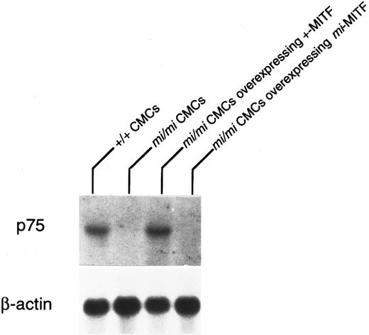 Fig. 1. Normalization of p75 expression in mi/mi CMCs by introduction of +-MITF cDNA. The Northern blot was hybridized with a 32P-labeled cDNA probe of p75 or β-actin.
