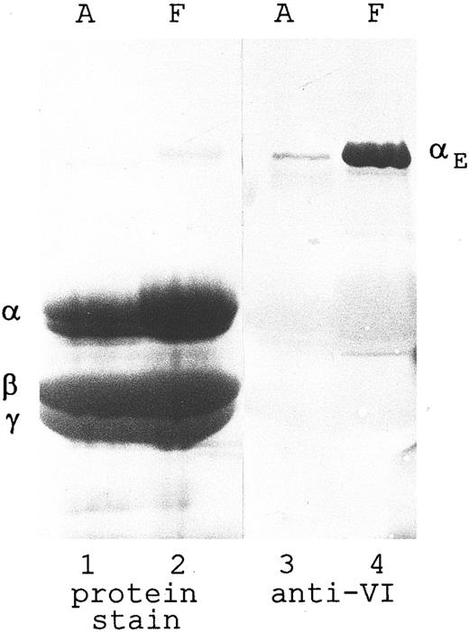 Fig. 1. Fibrinogen purified from adult and fetal sources: Disproportionately higher amount of αE chains in fetal material. Fibrinogen (I-2 fraction) was purified18 from plasma derived from normal adult blood (A) and umbilical cord (ie, fetal) blood (F ). The material was separated by SDS-PAGE (80 μg per lane) under reducing conditions and transferred to nitrocellulose. Lanes 1 and 2 were stained with Amido Black (Sigma); lanes 3 and 4 were treated with anti-VI, followed by HRPO-labeled antimouse IgG, and developed with chloronaphthol. Lanes 1 and 3, adult; and lanes 2 and 4, fetal. Positions of the individual chains are indicated. Overloading the gel enabled the Fib420-specific αE chain to be seen by protein staining as a faint band in lane 2 on the original blot.