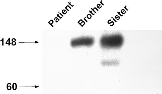 Fig. 1. Western blot analysis of GPIbα. Platelet lysate was analyzed by SDS-PAGE on an 8% to 16% exponential gradient in the presence of β-mercaptoethanol and immunoblotted with the anti-GPIbα MoAb MBC 142.6. There is no GPIbα present in platelet lysate from the patient.