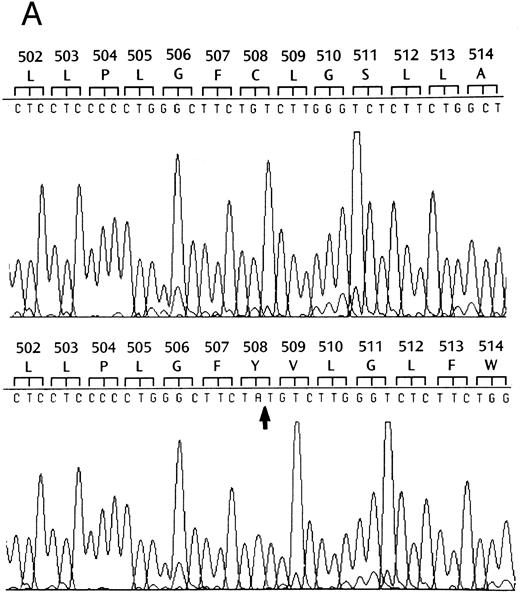 Fig. 2. Effects of the dinucleotide deletion on the secondary structure of GPIbα. (A) DNA sequence analysis of GPIbα from a normal individual (bottom) and the patient (top). Nucleotides 2059 and 2060 are deleted in the patient; deleted nucleotides are shown with an arrow. (B) Alignment of the transmembrane region (doubly underlined) of the wild-type GPIbα and the mutant protein (GPIbαΔAT). The start of the alternate reading frame resulting from the AT deletion in the mutant coding sequence is shown in bold type. The charged amino acids following the transmembrane region are shown with a +. (C) Hydropathy plot using the method of Kyte and Doolittle39 performed on the transmembrane and surrounding amino acids of the wild-type GPIbα and GPIbαΔAT. The hydropathy plot for the mutant protein is shown as a broken line.