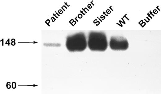 Fig. 3. Western blot analysis of plasma GPIbα. PPP was immunoprecipitated with MBC 142.2, analyzed by SDS-PAGE on an 8% to 16% exponential gradient in the presence of β-mercaptoethanol, and immunoblotted with MBC 142.6. WT is a normal non–family member wild-type sample. The patient's plasma contains a soluble GPIbα.
