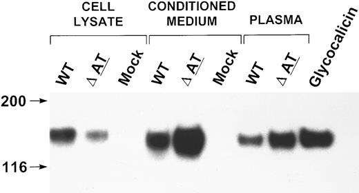 Fig. 4. Western blot analysis of expressed WT and mutant GPIbα. Cell lysate, conditioned medium of 293T transfected cells, and plasma from the patient and his brother were immunoprecipitated with MBC 142.2, analyzed simultaneously by SDS-PAGE on a 6% gel, and immunoblotted with MBC 142.6. The immunoprecipitate of the brother's PPP was diluted 1:25, and the patient's PPP was diluted 1:2. Purified glycocalicin 0.38 ng was analyzed on this gel simultaneously.
