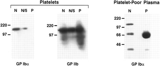 Fig. 2. Western blot analysis of GP Ibα in platelet lysates and plasma. GP Ibα or its degradation products in the patient's platelets and platelet-poor plasma were analyzed by immunoblotting with the GP Ibα antibody WM-23. Platelets from the patient (P) and from an unaffected control subject (N) were prepared from an equal volume of PRP. Platelet lysates were compared for GP Ibα content (left panel) and GP IIb content (middle panel, antibody G1.9). N/5 represents a fivefold dilution of the normal plasma. The right panel is an immunoblot of 20 μL normal plasma and patient plasma.