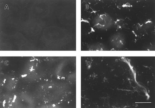 Fig. 1. Immunofluorescent detection of FBG in lung epithelial cell ECM. A549 cells grown on glass coverslips were treated with IL-6 and DEX for 18 hours (B through D) or untreated (A), fixed, and then stained with the following antibodies: (A and B) MoAb J88B for FBG; (C) PoAb for FN; and (D) MoAb COL-94 for collagen type IV. The bar in (D) represents 10 μm.