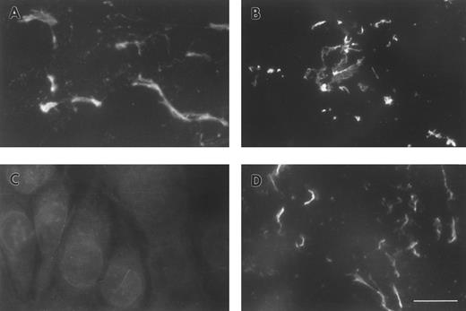 Fig. 2. ECM of A549 lung epithelial cells stained for FBG and fibrin-specific epitopes. IL-6 + DEX–treated cells were stained with (A) MoAb RDV3 for FPA; (B) MoAb 18C6 for FPB; (C) no primary antibody; or (D) MoAb T2G1 for fibrin β15-21. The bar in (D) represents 10 μm.