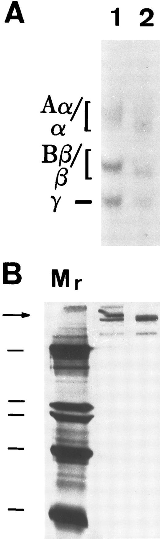 Fig. 3. Susceptibility of A549 lung cell-derived FBG to thrombin and plasmin cleavage. (A) Metabolically labeled FBG in A549 conditioned media was untreated (lane 1) or treated with thrombin (lane 2) and immunopurified and the resulting fibrin(ogen) Aα/α, Bβ/β, and γ chains were reduced then resolved on 7% polyacrylamide gels. (B) The untreated (lane 1) and plasmin-treated (lane 2) samples were resolved nonreduced on 8% polyacrylamide gels. The molecular weight markers (lane Mr ) in (B) are, from top to bottom, 200, 97, 68, and 46 kD. Intact FBG (340 kD) is denoted by the arrow.