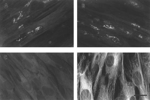 Fig. 5. Exogenously produced FBG deposition in preformed matrix of fibroblasts. A549 cell conditioned media (A) or purified plasma FBG (B) was added to confluent monolayers of HFFs grown on glass coverslips and then cultured for 3 days. The cells were fixed and stained, nonpermeabilized (A through C), with MoAb J88B for FBG (A and B) and an MoAb for α-tubulin (C). Permeabilized HFFs were stained with the MoAb for α-tubulin (D). The bar in (D) represents 15 μm.