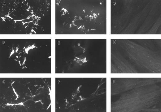 Fig. 6. Exposure of FBG and fibrin-specific epitopes on A549 lung cell-derived FBG and plasma FBG deposited in the ECM of fibroblasts. Immunofluorescent staining was performed using MoAbs specific for FPA (A, D, and G), FPB (B, E, and H), and fibrin β15-21 (C, F, and I). HFFs were overlaid with conditioned media from A549 cells (A through C), with complete media containing purified plasma FBG (D through F ), or with complete media with no added ligand. The bar in (I) represents 10 μm.
