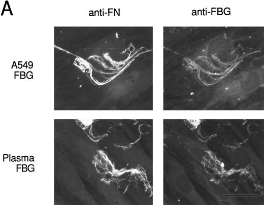 Fig. 8. Colocalization of FBG with ECM constituents in HFF matrix detected by dual immunofluorescent staining. FBG from lung A549 epithelial cells or plasma was overlaid onto HFF cultures for 3 days. Matrix fibrils were detected by dual staining with anti-FN and MoAb J88B (A) or anti-LN and MoAb J88B (B) antibodies. The bar represents 20 μm.