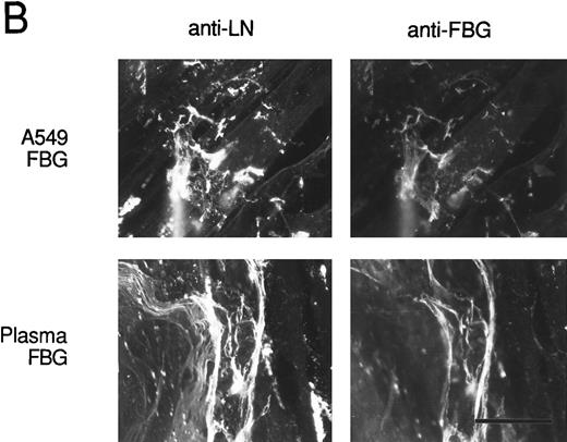 Fig. 8. Colocalization of FBG with ECM constituents in HFF matrix detected by dual immunofluorescent staining. FBG from lung A549 epithelial cells or plasma was overlaid onto HFF cultures for 3 days. Matrix fibrils were detected by dual staining with anti-FN and MoAb J88B (A) or anti-LN and MoAb J88B (B) antibodies. The bar represents 20 μm.