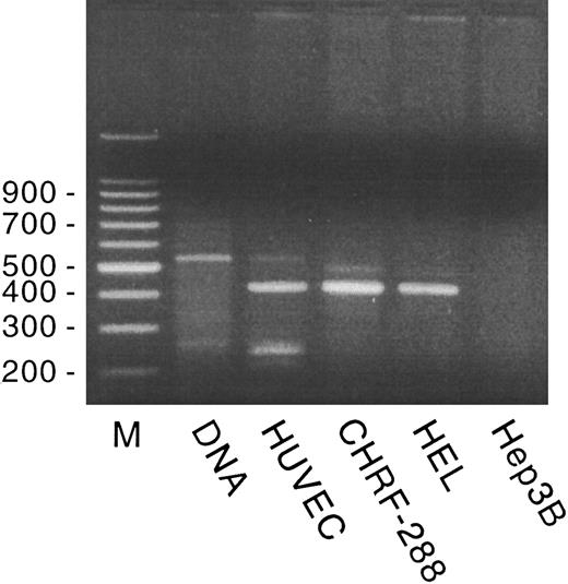 Fig. 1. GpIX expression in HUVECs, CHRF-288, and HEL cells. Genomic DNA or RT-RNA from HUVECs, CHRF-288, and HEL cells and from hepatoma 3B cells was amplified by PCR, as described in Materials and Methods, using GpIX primers that span the 108-bp intron in the GpIX 5′ untranslated region. A 100-bp marker ladder (M) is shown on the left.