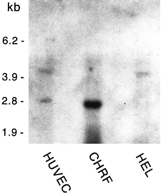 Fig. 2. GpV mRNA expression in HUVECs, CHRF, and HEL cells. Poly A+-selected RNA was extracted from confluent HUVECs (third passage), CHRF-288 cells, and HEL cells. Four micrograms of RNA was analyzed by Northern blotting using radiolabeled GpV cDNA as the probe. An RNA size ladder is shown on the left.