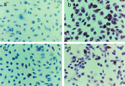 Fig. 3. Immunohistochemical identification of the GpIb complex in HUVECs. Cultured HUVECs were stained with affinity-purified rabbit polyclonal antibodies to the whole glycoprotein chains: (a) GpIbα, (b) GpIbβ, (c) GpIX, and (d) GpV. For experimental details, see Materials and Methods.