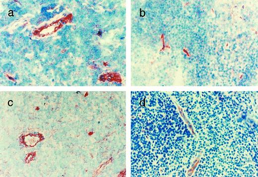 Fig. 4. Immunohistochemical identification of the GpIb complex in tonsillar endothelium. Sections of tonsil were stained with affinity-purified rabbit polyclonal antibodies to the whole glycoprotein chains: (a) GpIbα, (b) GpIbβ, (c) GpIX, and (d) GpV. For experimental details, see Materials and Methods.
