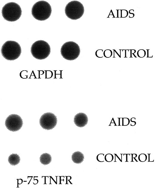 Fig. 4. Dot blot analysis of mRNA levels for p75-TNFR in freshly isolated PBMC from three AIDS patients and three healthy controls. When comparing mRNA levels between HIV-1–infected patients and healthy controls, a quantitative estimate of the p75-TNFR mRNA was attempted by comparing with mRNA level for the GAPDH gene.