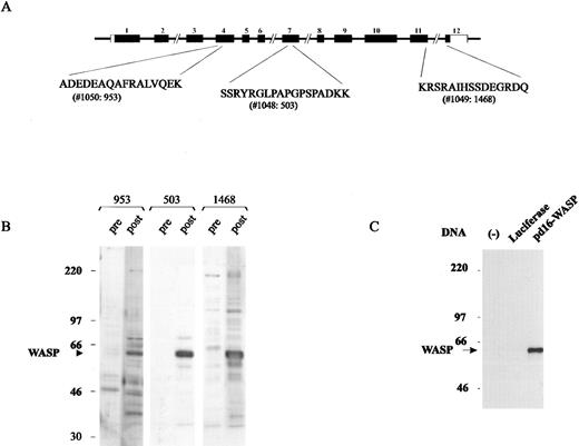 Fig. 1. Anti-WASP antisera. (A) WASP-derived peptides used in the production of rabbit anti-WASP antibody (Ab). (B) Assessment of Ab953, Ab503, and Ab1468 using Western blot analysis of normal B-LCL lysate and preimmunization and postimmunization antisera. (C) Only protein translated from WASP gene mRNA, not from luciferase gene mRNA, was recognized by Ab503 as a single band of 62 kD, demonstrating that the antibody was specific for WASP.