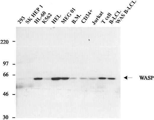Fig. 2. Expression of WASP in human cell lines. Western blot analysis of lysates from various hematopoietic cell lines (HL-60, K562, HEL, MEG01, Jurkat, normal IL-2–dependent T-cell line, normal B-LCL, and a B-LCL from a WAS patient with the classic phenotype) and 2 nonhematopoietic cell lines (293 and SK HEP1). All hematopoietic cell lines express WASP, with the exception of the B-LCL derived from a WAS patient. Nonhematopoietic cell lines do not express WASP.