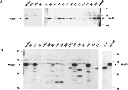 Fig. 3. Western blot analysis of cell lysates (B-LCLs) from WAS patients (see Table 1 for detailed description of the mutations). (A) Blots from patients with nonsense mutations or missense mutations affecting exons 1 to 4. (B) Blots from patients with splice-site mutations, insertions, or deletions located in exons 7 to 11 (except patient SD, who has a splice-site mutation affecting intron 3).