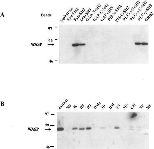 Fig. 4. In vitro interaction of WASP and SH3-containing proteins. (A) Proteins containing SH2 and SH3 domains were used to affinity-precipitate WASP. Of 5 SH3-GST fusion proteins, 4 (Fyn, Lck, PLC-γ, and Grb2) were able to bind WASP. None of the SH2-GST fusion proteins were able to bind WASP. (B) Lysates of B-LCLs established from 12 WAS patients, some expressing WASP, were incubated in vitro by Fyn SH3-GST fusion protein agarose beads. Only patients with demonstrable WASP showed a band (JS, JH, JG, JD, TS, and possibly CH).