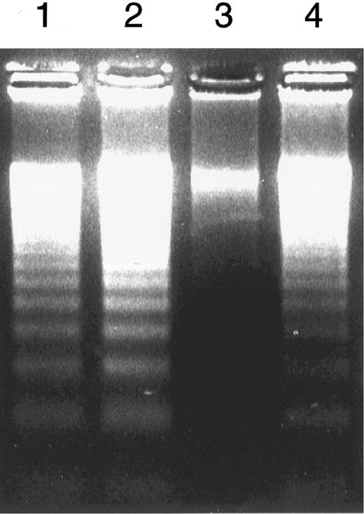Fig. 1. DNA ladder formation. Granulocytes obtained from representative healthy volunteers (lanes 1 and 2) and patients with PNH (lanes 3 and 4) underwent apoptosis in the absence (lanes 1 and 3) and the presence (lanes 2 and 4) of anti-FAS MoAb (IgM, 50 ng/mL) for 6 hours.