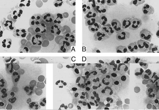 Fig. 4. May-Giemsa staining. Granulocytes from a patient with PNH (A, C) and a healthy donor (B, D) were stained immediately after isolation (A, B) and after a 9-hour incubation in the absence of anti-FAS MoAb (C, D).