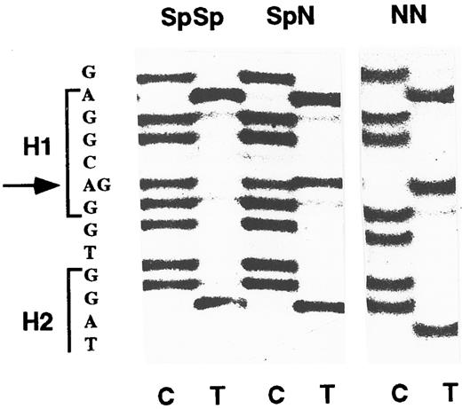Fig. 1. MPO genotypes determined by direct sequencing of PCR products. A DNA fragment including the -463 G/A base difference was amplified by PCR and directly sequenced using an internal primer. Positions of hexamers 1 and 2 (H1 and H2) are indicated in the sequence at left. The sequence of the opposite strand was determined using dideoxynucleotide C and T termination reactions as indicated at bottom. The SpSp homozygous genotype is identified by the G residue at -463 (arrow); the heterozygous SpN genotype has both G and A residues, and the homozygous NN genotype has only A.