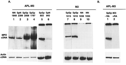 Fig. 3. Relative amount of MPO mRNA detected by RT-PCR in primary AML cells of the M3 or M2 subclasses. (A) Autoradiograph shows radiolabeled RT-PCR products from primary AML cells. Lanes 1 to 10, AML-M3 or -M4 cases from Table 1. The top panel shows 550-bp PCR products derived from random primed cDNA using MPO primers. The bottom panel shows products from a separate PCR using actin primers. The reactions in lanes 1 to 4 and 5 to 10 are from different experiments. (B) APL cells from patient no. 803 were cultured for 20 hours in the presence (+RA) or absence (−RA) of RA (10−6 mol/L). RT-PCR was performed with MPO primers. Lane 1 is the same as lane 5 in A. The actin control reactions were repeated to include both cDNAs. (C) Range of MPO transcript levels in the different AML donor cells in multiple experiments is shown with standard deviations indicated. Time in culture ranged from 48 hours to 2 weeks before RNA isolation. Different RT-PCR experiments were normalized to β-actin cDNA levels and also to the MPO signal from a cDNA standard prepared from the NB4 cell line (APL-derived). Relative amount of MPO protein in the different AML cell samples was determined by SDS gel electrophoresis of whole-cell extracts. Proteins were blotted onto nylon membrane, reacted with anti-MPO antibodies, and quantified. Values shown are an average of 3 separate experiments.