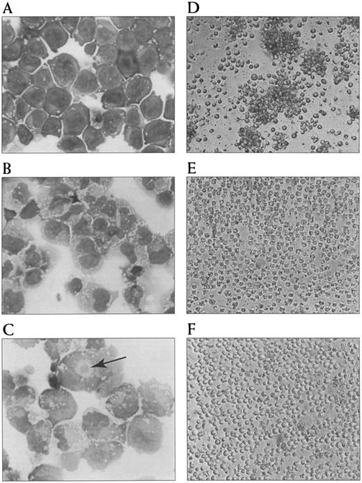 Fig. 1. Photomicrographs of morphological changes and aggregation in response to tRA and its inhibition by LFA-1 α and ICAM-2 MoAb. Morphological features of NB-4 cells untreated (A), treated with 100 nmol/L tRA for 24 hours (B), and treated with 100 nmol/L tRA for 72 hours (C). An arrow indicates an eosinophilic perinuclear hof. Aggregation of NB-4 cells treated with tRA for 72 hours (D) and its inhibition by LFA-1 α (E) and ICAM-2 (F ) MoAb are shown.