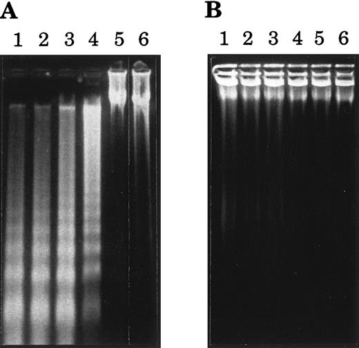 Fig. 1. Agarose gel electrophoresis of DNA from BL cells treated with 38.13 anti-CD77 MoAb. BL cells were incubated for 24 hours in Petri dishes that had been previously coated with RARa and 38.13 MoAb (A) or with RARa alone (B). DNA was then prepared and analyzed by 2% agarose gel electrophoresis. Lane 1, CD77+ BL2 cells; lane 2, CD77+ Ramos cells; lane 3, CD77+ Daudi cells; lane 4, CD77+ MUTU I cells; lane 5, CD77− Namalwa cells; lane 6, CD77− MUTU III cells.