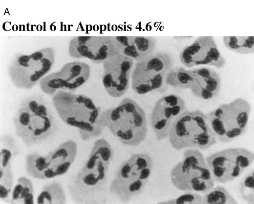 Fig. 2. Effect of TNF-α on neutrophil morphology and propidium iodide (PI) staining. Human neutrophils were incubated in the presence (A and B, righthand panels) or absence (A and B, lefthand panels) of 12.5 ng/mL TNF-α as detailed in the legend to Fig 1. (A) Cytocentrifuge preparations were prepared after 6 hours and cells fixed, stained, and examined under 100× objective oil immersion light microscopy. Cells with classical apoptotic morphology are arrowed. (B) After 6 or 20 hours in culture cells were resuspended in ice-cold 70% ethanol, washed in PBS, and incubated with PI in the presence of RNAase before analysis using an EPICS Profile II. Mean fluorescence values are shown for a minimum of 5,000 cells for each condition and are representative of six to nine determinations in three separate experiments.