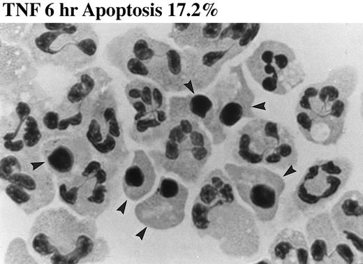 Fig. 2. Effect of TNF-α on neutrophil morphology and propidium iodide (PI) staining. Human neutrophils were incubated in the presence (A and B, righthand panels) or absence (A and B, lefthand panels) of 12.5 ng/mL TNF-α as detailed in the legend to Fig 1. (A) Cytocentrifuge preparations were prepared after 6 hours and cells fixed, stained, and examined under 100× objective oil immersion light microscopy. Cells with classical apoptotic morphology are arrowed. (B) After 6 or 20 hours in culture cells were resuspended in ice-cold 70% ethanol, washed in PBS, and incubated with PI in the presence of RNAase before analysis using an EPICS Profile II. Mean fluorescence values are shown for a minimum of 5,000 cells for each condition and are representative of six to nine determinations in three separate experiments.