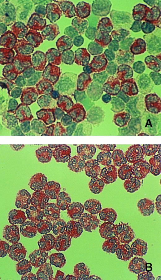 Fig. 4. Immuno-cytochemistry of cells from BM. (A) Cells from band 2 (mainly myelocytes, and metamyelocytes, and some band cells). (B) Cells from band 1 (mainly band cells and segmented cells). Cytospin preparations were immuno-reacted with anti-hCAP-18 antibody. hCAP-18 starts to appear in metamyelocytes and is prominent in all more mature cells (band cells and segmented cells).