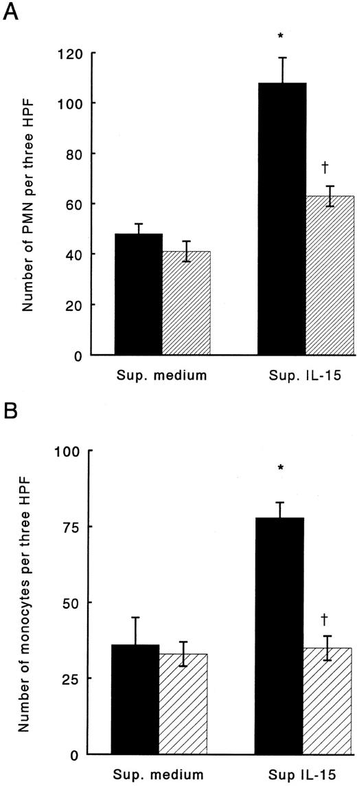 Fig. 1. Chemotactic activity of supernatants derived from monocytes stimulated with IL-15 for PMN (A) or monocytes (B). (▪) Supernatants treated with control IgG. (▨) Supernatants treated with anti-IL-8 or anti-MCP-1 neutralizing antibodies. Results represent mean ± SE of three independent experiments. *Significant chemotactic response in comparison to medium (P < .05). †Significant inhibition by treatment with neutralizing antibodies in comparison to treatment with control IgG (P < .05).