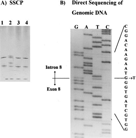 Fig. 2. Detection of the band 3 gene mutation in HS patients. (A) SSCP analysis of the exon 8 and intron-exon boundaries showing a band shift in a patient with band 3 deficiency (patient II.2, lane 2). Samples applied on lanes 1, 3, and 4 belong to three unrelated patients with band 3 deficiency. (B) Direct sequencing of the PCR product showing a mutation in intron 8, position + 1G → T.