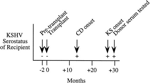 Fig. 1. Serial serologic results for a Northern Italian female kidney transplant patient who developed KS 27 months after transplantation. This patient was KSHV seronegative before transplantation, but seroconverted at 13 months after transplantation with onset of Castleman's disease (CD). Serum from the living-related donor was seropositive at 30 months after transplantation.