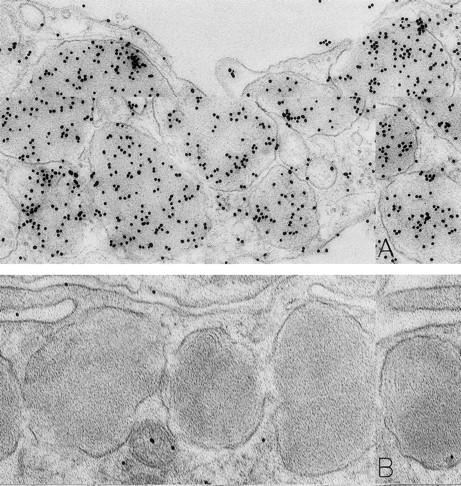 Fig. 1. Mast cells in skin biopsies obtained 1 hour 40 minutes (A) or 2 hours (B) after the SC injection of 25 or 5 μg/kg rhSCF, respectively, in patients no. 3 (A) and no. 1 (B), who had received daily SC injections of rhSCF for 13 days. Reactivity for histamine is indicated by DAO-gold labeling in the cytoplasmic granules of a mast cell that exhibits no morphologic evidence of secretory activity (A); DAO-gold label is absent when the grid containing a section of the specimen was digested with DAO before staining with DAO-gold (B). Original magnifications: (A) ×67,500; and (B) ×75,000.