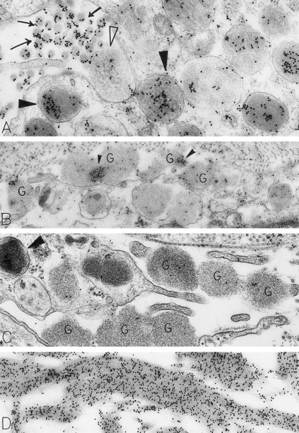 Fig. 2. Skin biopsies from sites that had been injected with rhSCF, obtained from patients no. 2 and no. 3 who had received rhSCF for 13 days (A) or 1 day (B through D), respectively. The biopsy in (A) was obtained 1 hour 45 minutes after the SC injection of 5 μg/kg of rhSCF, whereas the biopsy in (B), (C), and (D) was obtained 1 hour 40 minutes after the SC injection of 25 μg/kg of rhSCF. A large amount of DAO-gold label is present on the electron-dense contents of cytoplasmic granules in the mast cell in (A; solid arrowhead); the cell exhibits evidence of secretory activity, and an extruded, non–membrane-bound granule with altered matrix (which is located external to the plasma membrane) retains very little DAO-gold label for histamine (open arrowhead). However, DAO-gold heavily labels adjacent collagen fibers, which are seen in cross-section (arrows). In (B), multiple extruded, membrane-free mast cell granules (G), which exhibit altered matrix materials, are present in the interstitium near the degranulating mast cell; these extruded granules exhibit relatively little DAO-gold labeling for histamine, except in regions of the granules that contain the most electron-dense matrix material (solid arrowheads). In (C), the DAO-gold was absorbed with solid-phase histamine before being used to stain the specimen. Nearly all DAO-gold staining of intracellular mast cell granules (arrowhead), as well as of the extruded, membrane-free granules (G), was abolished by this specificity control. (D) shows that the extensive fibrin deposits in the extracellular space in this biopsy are heavily labeled with DAO-gold. Original magnifications: (A) ×52,500; (B) ×28,000; (C) ×46,500; and (D) ×45,000.