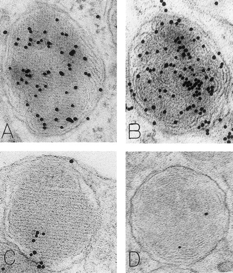Fig. 3. Mast cell granules in skin biopsies of rhSCF-injected sites from patients who had received rhSCF for 6 days (A and B; obtained 2.5 hours after the SC injection of 5 μg/kg of rhSCF in patient no. 2) or 13 days (C and D, obtained 2 hours after the SC injection of 5 μg/kg of rhSCF in patient no. 1). The photomicrographs illustrate the ultrastructure of electron-dense granules in nonsecretory mast cells. Parallel crystalline arrays, oriented either in several directions (A) or all in one direction (C), are typical for the cytoplasmic granules of human skin mast cells. The DAO-gold staining (A) was largely abrogated by absorption of the DAO-gold with solid-phase histamine before staining (C). The granule in (B) is filled with a membranous scroll pattern that is also heavily labeled with the DAO-gold. The DAO-gold staining is not seen in the scroll granule in (D) from a section that was digested on the grid with DAO before DAO-gold staining. Original magnifications: (A) ×110,000; (B) ×136,500; (C) ×93,000; and (D) ×72,000.