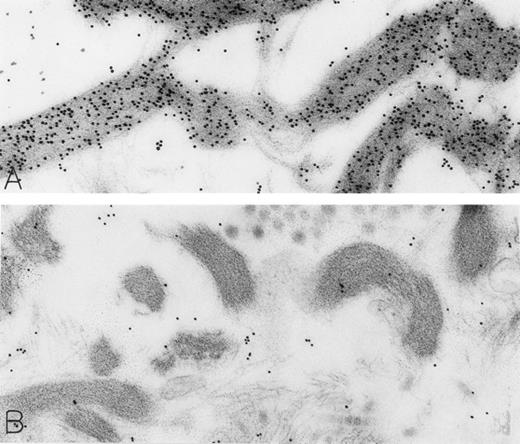 Fig. 4. A skin biopsy from an rhSCF-injected test site (obtained 1 hour 40 minutes after the SC injection of 25 μg/kg of rhSCF ) from patient no. 3, who had received a single dose of rhSCF (day 1 of dosing), shows extensive DAO-gold-labeled fibrin (A) that is not seen if the section was digested with DAO before staining with DAO-gold (B). Original magnifications: (A) ×56,000; and (B) ×52,000.