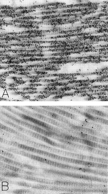 Fig. 5. Skin biopsies of rhSCF-injected test sites from patients who had received rhSCF for 1 day (A; obtained 1 hour 40 minutes after the SC injection of 5 μg/kg of rhSCF in patient no. 2) or 6 days (B; obtained 2.5 hours after the SC injection of 25 μg/kg of rhSCF in patient no. 3) show DAO-gold staining of collagen (A) that is largely abrogated by absorption of the DAO-gold with histamine before staining (B). Original magnifications (A) ×31,000; and (B) ×38,500.