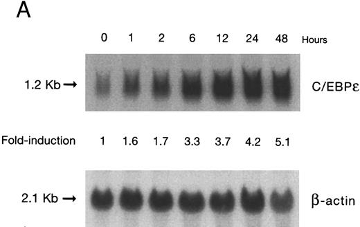 Fig. 1. (A) Time-response: C/EBPε mRNA expression in NB4 cells cultured with 9-cis RA. Northern blot with total RNA (30 μg/lane) of NB4 exposed for various lengths of time to 9-cis RA (5 × 10−7 mol/L) and probed with full-length C/EBPε cDNA. The bottom panel shows ethidium bromide-staining of the 28S and 18S rRNA on the gel as assessment of RNA quantities in each lane. Fold-inductions were calculated by the ratio of densitometry readings of C/EBPε to β-actin. (B) Dose-response: C/EBPε mRNA levels in NB4 cells treated with 9-cis RA. Northern blot of total RNA (30 μg/lane) of NB4 cells exposed to various concentrations of ATRA for 12 hours and hybridized with full-length C/EBPε cDNA probe. The bottom panel shows hybridization with the β-actin probe as assessment of RNA quantities in each lane. Fold-inductions were calculated by the ratio of densitometry readings of C/EBPε to β-actin.