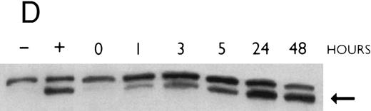Fig. 3. (A) Rate of transcription of C/EBPε in untreated NB4 cells (control) and NB4 cells induced for 12 hours with 9-cis RA (5 × 10−7 mol/L). Nuclei were isolated for run-off experiments as described in the Materials and Methods. Equivalent counts of 32P-labeled RNA transcripts were hybridized to plasmids immobilized on nitrocellulose membranes as indicated (MPO, full-length MPO cDNA in PUC vector; pcDNA, empty pcDNA vector; C/EBPε, full-length C/EBPε antisense cDNA in pcDNA vector; β-actin, 3′ UT β-actin in PBR322 vector). (B) Half-life of mature C/EBPε RNA in NB4 cells. Northern blot of total RNA (30 μg/lane) of NB4 cells exposed for 0 to 4 hours to actinomycin (10 μg/mL) with or without prior treatment with 9-cis RA as indicated. (C) Effect of a protein synthesis inhibitor on C/EBPε RNA expression. Northern blot with total RNA (30 μg/lane) of NB4 cells treated either with 10 μg/mL CHX alone, with CHX (10 μg/mL) and 9-cis RA (5 × 10−7 mol/L), or with 9-cis RA (5 × 10−7 mol/L) alone. Cells were harvested at 0, 4, 6, and 8 hours. The top panel shows the hybridization with full-length C/EBPε cDNA probe. The bottom panel shows the hybridization with β-actin probe as assessment of RNA quantities on each lane. Fold-inductions were calculated by the ratio of densitometry readings of C/EBPε to β-actin. (D) Effect of ATRA on C/EBPε protein expression in NB4 cells. NB4 cells were cultured with ATRA (5 × 10−7 mol/L) for different durations. Lysates were made from the cells and Western blotted. COS cells transfected with either a human C/EBPε cDNA expression vector (lane +) or empty vector (lane −) were used as positive and negative controls, respectively. The arrow denotes C/EBPε protein as seen by Western blot.