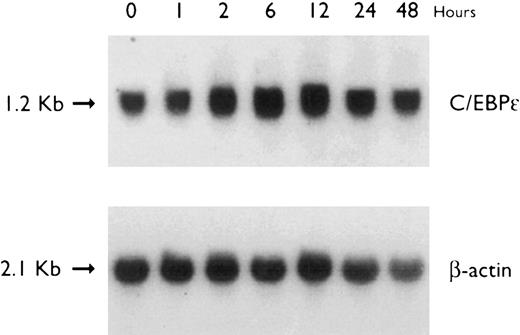 Fig. 4. Regulation of C/EBPε expression in U937 cells by ATRA. Northern blot of total RNA (30 μg/lane) of U937 cells exposed for various lengths of time to ATRA (5 × 10−7 mol/L). The top panel shows the hybridization with full-length C/EBPε cDNA probe, and the bottom panel shows the hybridization with β-actin cDNA probe as assessment of RNA quantities in each lane.