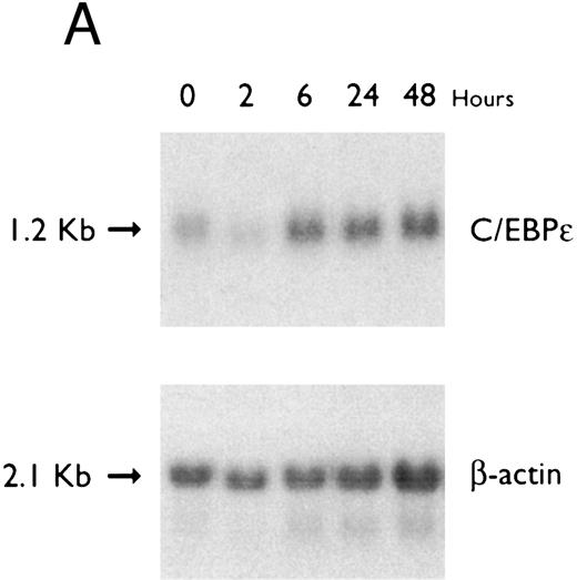 Fig. 5. (A) Regulation of C/EBPε expression in HL60 cells by ATRA. Northern blot of total RNA (20 μg/lane) of HL60 cells exposed for various lengths of time to ATRA (5 × 10−7 mol/L). The top panel shows the hybridization with full-length C/EBPε cDNA probe, and the bottom panel displays the hybridization with β-actin cDNA probe as assessment of RNA quantities in each lane. (B) Regulation of C/EBPε expression in HL60 cells by DMSO. Northern blot of total RNA (20 μg/lane) of HL60 cells exposed for various lengths of time to DMSO (1.25%). The top panel shows the hybridization with full-length C/EBPε cDNA probe, and the bottom panel shows the hybridization with β-actin cDNA probe as assessment of RNA quantities in each lane.